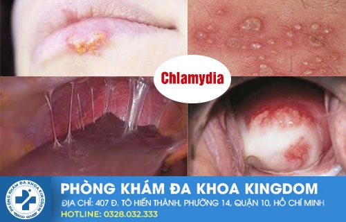 Chữa mụn rộp sinh dục ở đâu